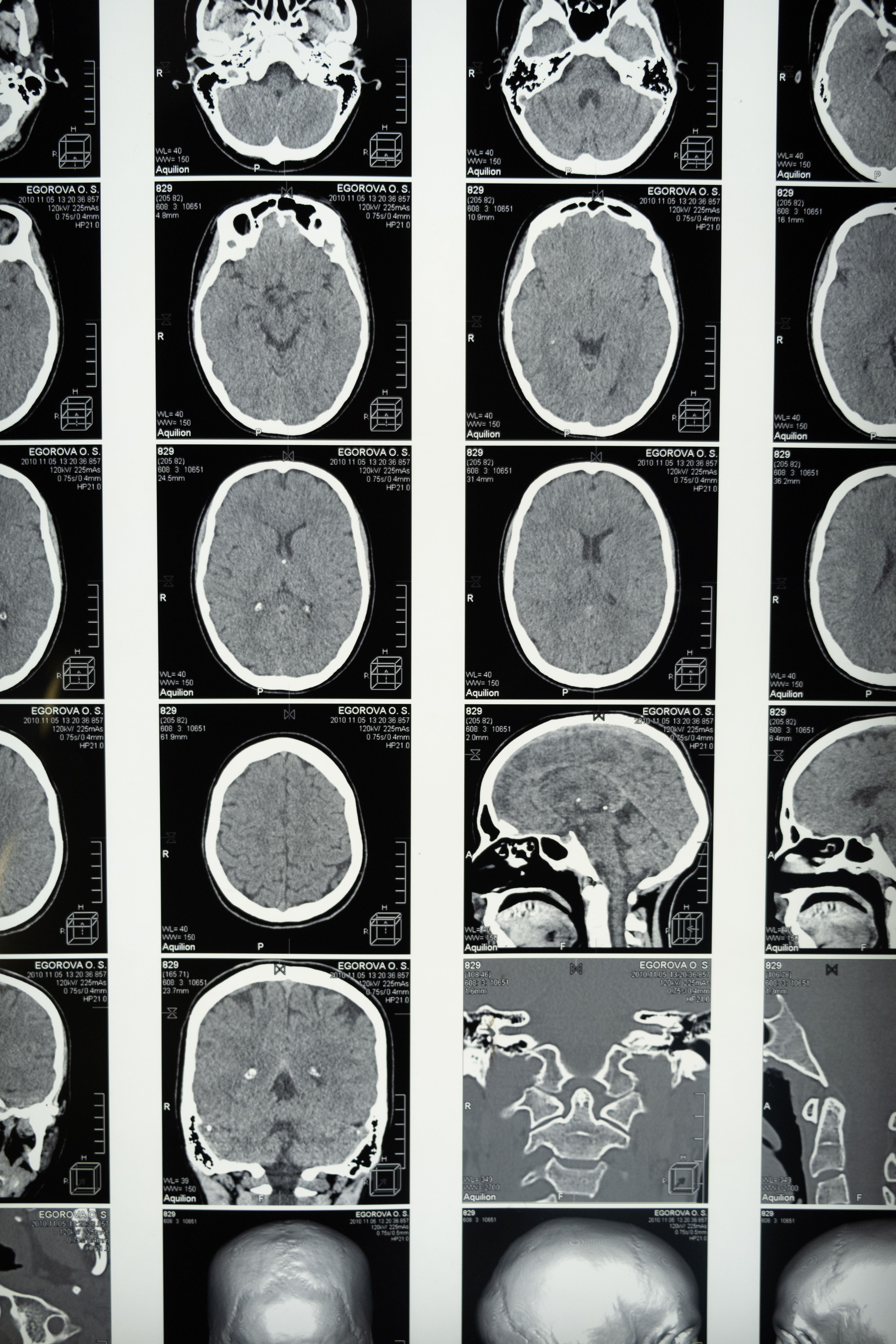 CT scan sample