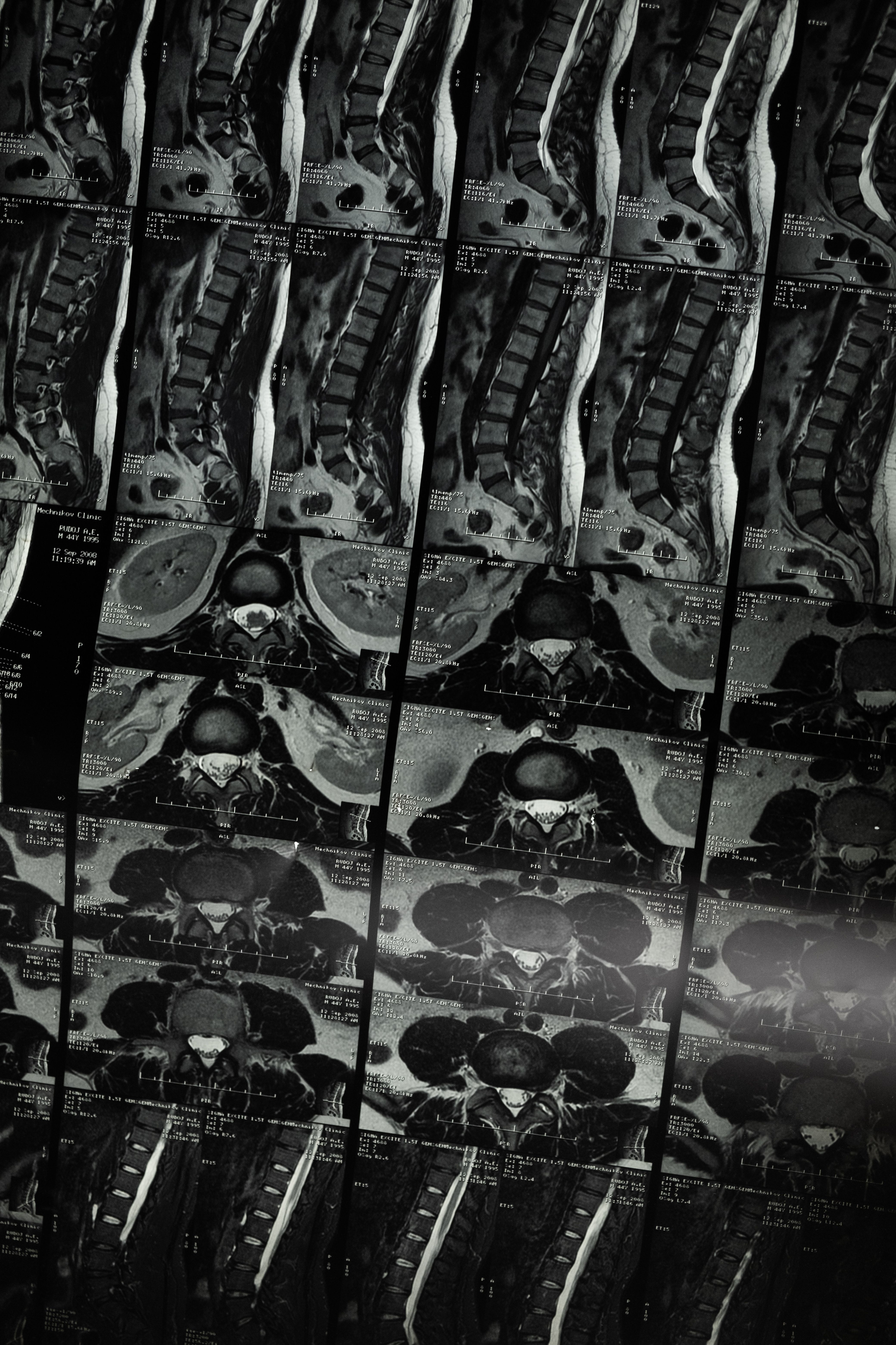 MRI sample